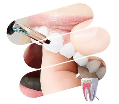 深圳牙科医院‍解读缺少牙齿的坏处有哪些