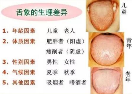 舌诊培训需要注意的事项有哪些 舌诊培训需要注意的事项有哪些