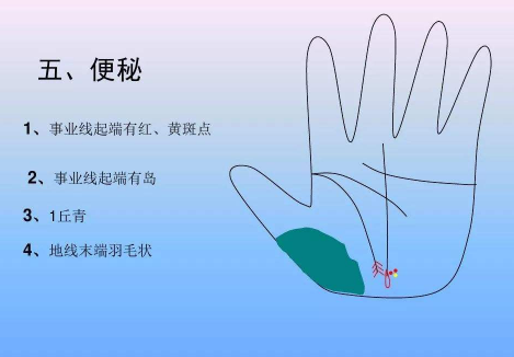 手诊培训值得学习的内容体现 手诊培训值得学习的内容体现