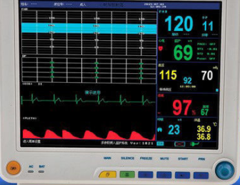 医用监护仪‍2.png