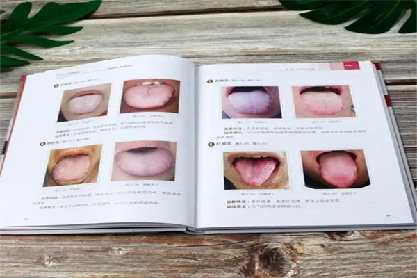 中医舌诊仪图片